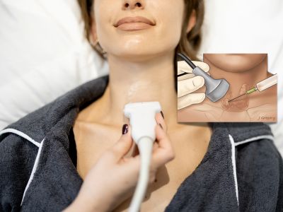 παρακεντηση θυρεοειδή